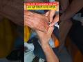 IV Cannulation Shorts video #reels #usa #youtubeshorts #trending #trendingshorts #viral #viralshorts