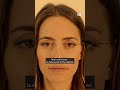 Albania appoints AI minister to fight corruption | DW News