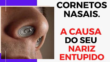 Quais são os cornetos nasais?