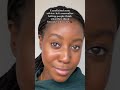 unsolicited acne advice | Lakisha Adams