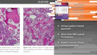 Practical Orthopedic Pathology: A Diagnostic Approach