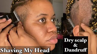 Shaving My Head || Struggling with Dry scalp & Dandruff
