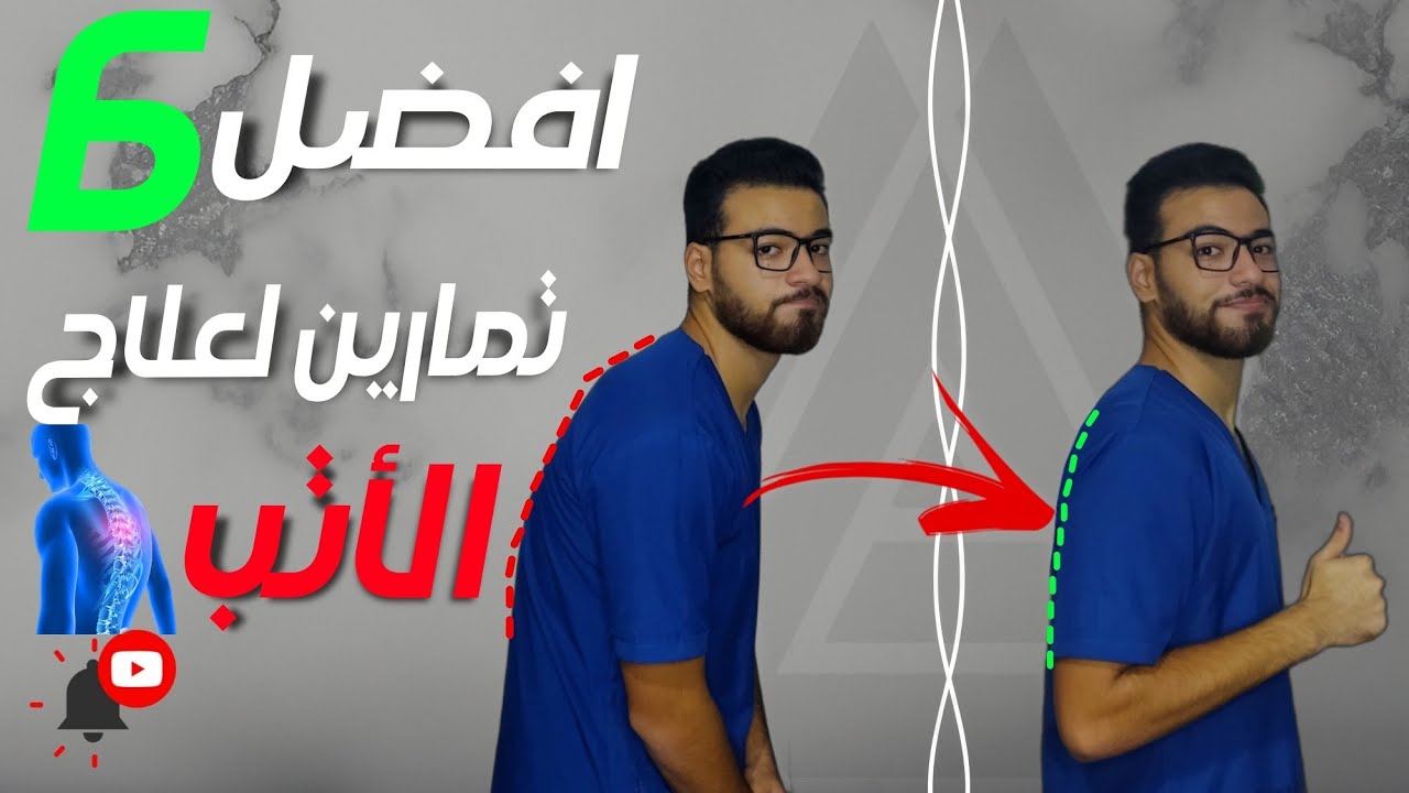 6 تمرينات ونصائح للقضاء نهائيا علي مشكله الاتب(تقوس الظهر) والتواء ...