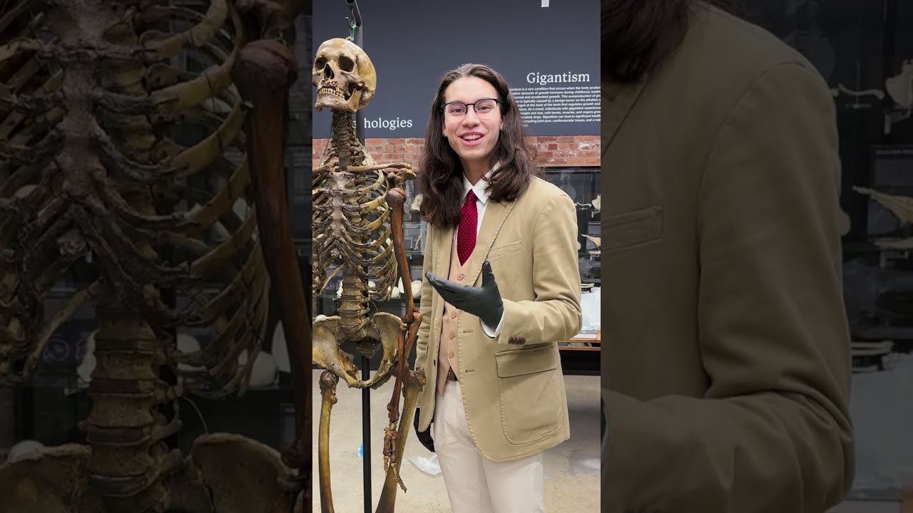 "WHERE DO THE BONES COME FROM???" - The Bone Museum FAQ