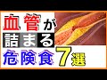 【命の危険！】血管が詰まる、動脈硬化を起こす食べ物７選［血管が詰まる/動脈硬化/食べ物］