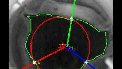 Heartvalve analysis with ProAnalyst