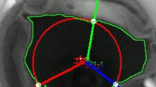 Heartvalve analysis with ProAnalyst