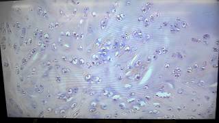 A&P1 Lab#3 fibrocartilage