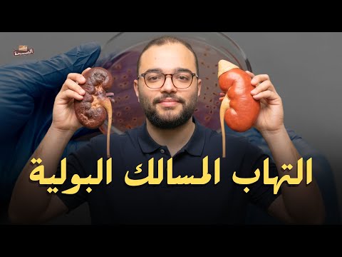 التهابات المسالك البولية التهاب البول المتكرر تنقيط البول الاسباب والعلاج مكتب الصحة