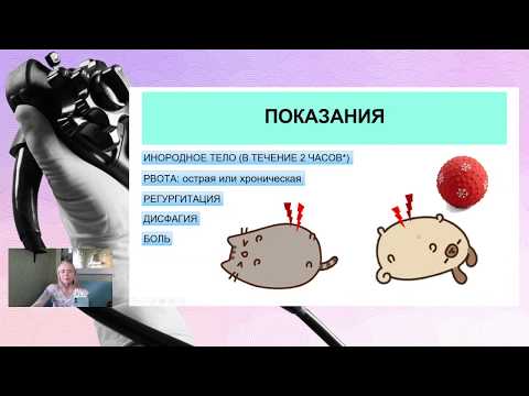 Видео: Езофагоскопия: Определение, Vs. Ендоскопия, приложения и др