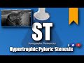 Pyloric ultrasound