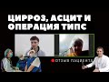 Подробный отзыв об операции ТИПС при асците.