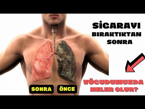 Sigarayı Bıraktıktan Sonra Vücudumuzda Neler Oluyor? (Sigaranın Zararları )