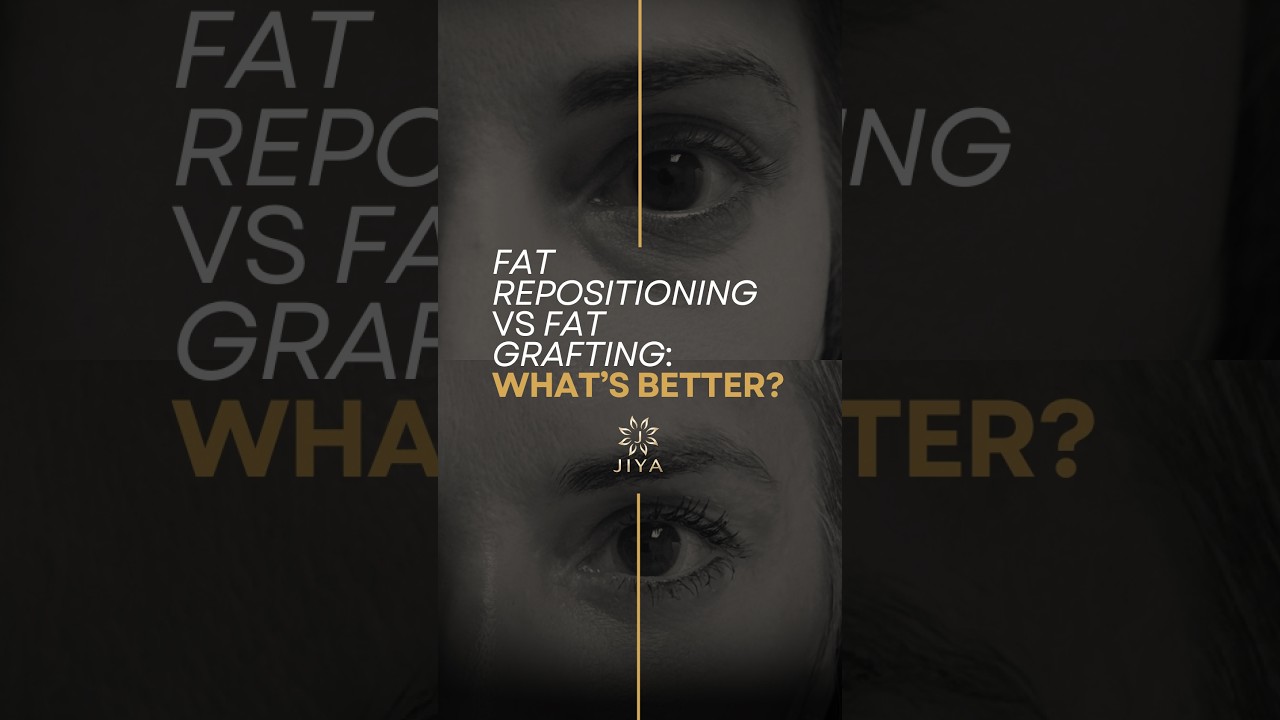 FAT REPOSITIONING VS FAT GRAFTING: WHAT'S BETTER?
