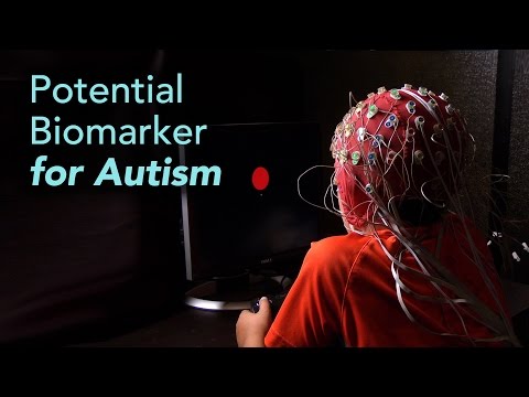 Measuring Brainwaves Could Lead To An Objective Autism Diagnosis