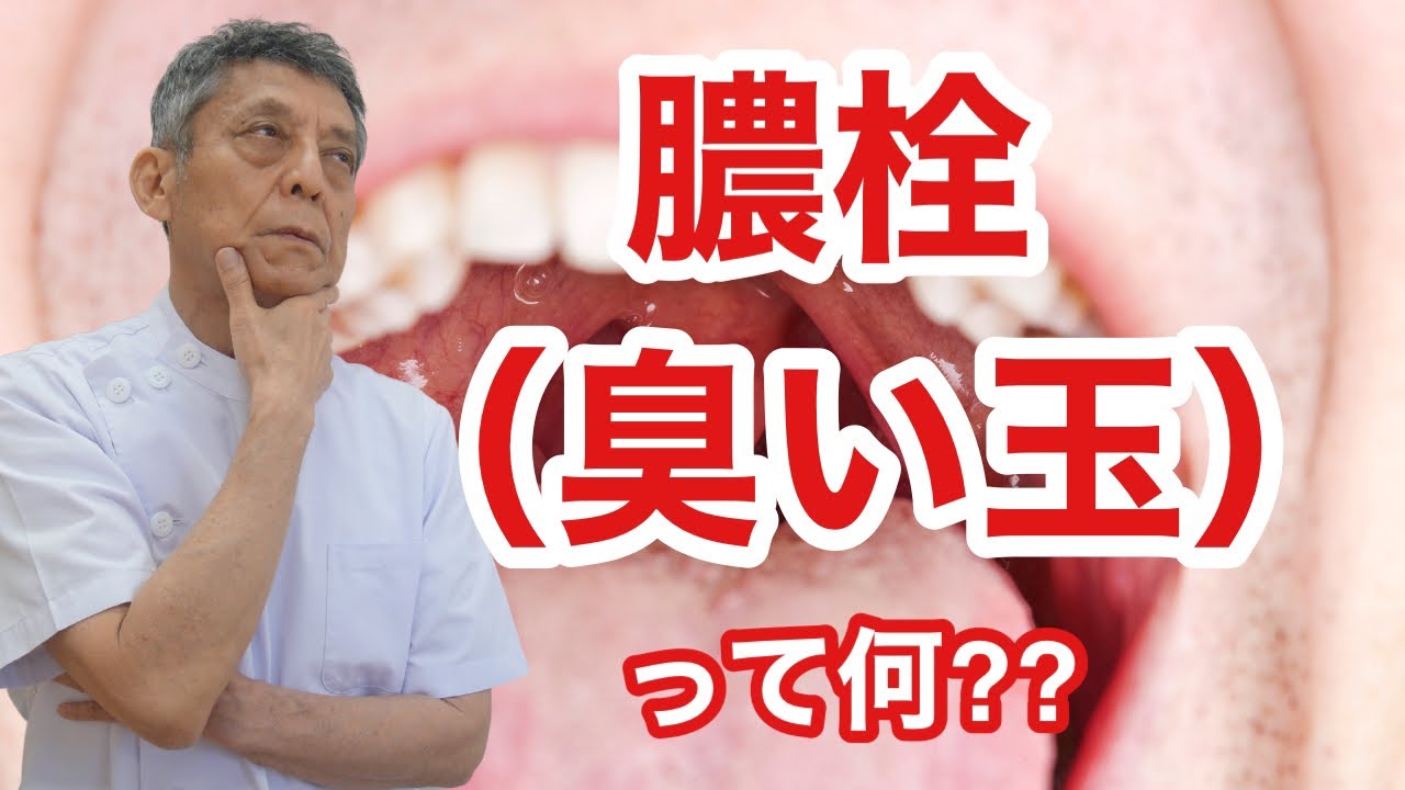 膿栓取り方 _ 膿栓 取り方 うがい – ZJFK