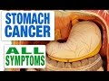 Stomach Cancer - All Symptoms