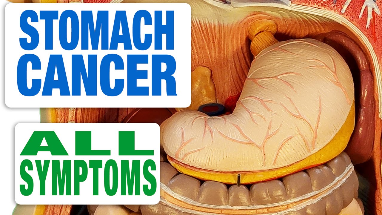 Symptoms Of Stomach Cancer Stomach Cancer Symptoms Causes Treatment