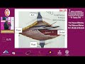 Day1 session 5.2 cerebral palsy - equinus foot - Mostafa ElSherbini NINMS