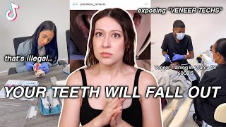 EXPOSING The 'Veneer Techs' of Tiktok! *your teeth will fall out*
