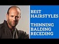 Best Men's Hairstyles for Thinning Hair, Balding Hair, or Receding Hair Line