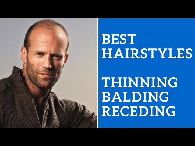 4 Best hairstyles for Balding men. . . . . #lifestylebyap #lifestyle  #mensfashion #attractiveshirt #accessories #modernmencasualstyle… |  Instagram