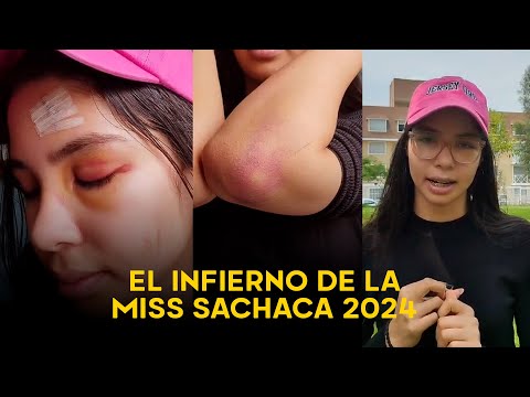 Arequipa: el infierno de Miss Sachaca que casi la convierte en víctima de feminicidio