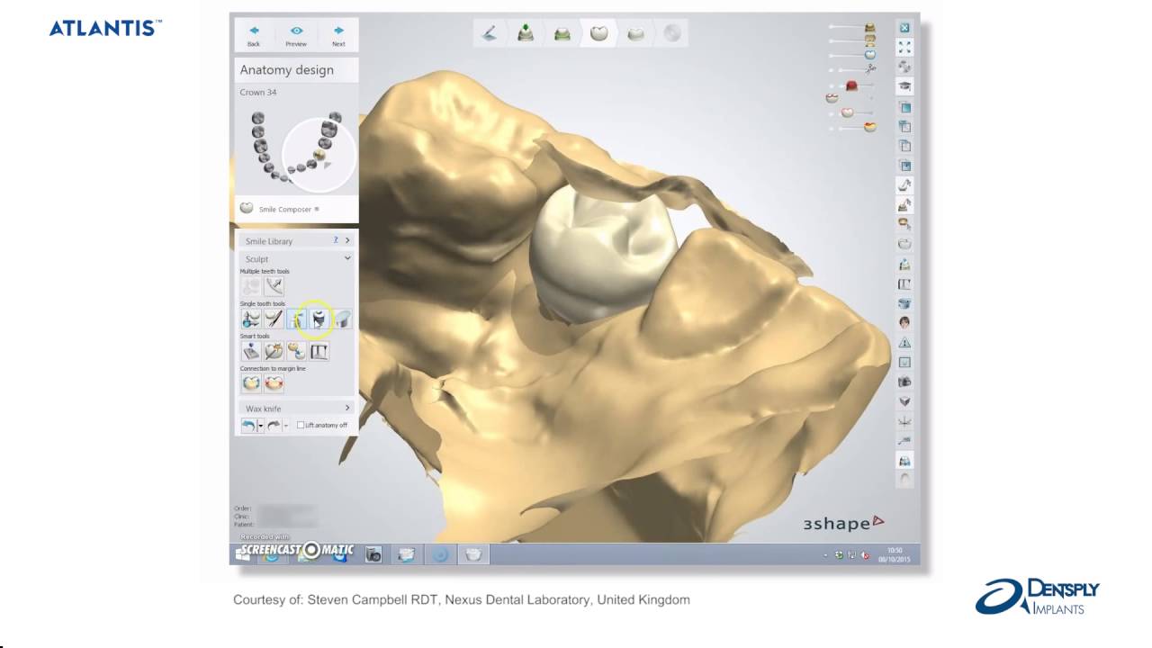 Atlantis™ abutments− Atlantis abutment Core File Dentsply Sirona