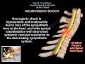 Spinal Cord injury , Examination & Evaluation  - Everything You Need To Know - Dr. Nabil Ebraheim