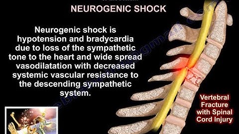 Spinal Cord injury , Examination & Evaluation  - Everything You Need To Know - Dr. Nabil Ebraheim