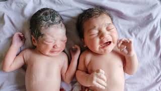 Gorgeous Twins Boy and Girl just after birth