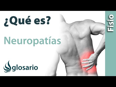 Vídeo: Neuropatía Diabética: Tratamiento, Síntomas, Causas