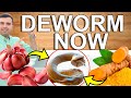 DEWORM NOW! - How to Parasite Cleanse at Home - Home Remedies That Cleanse And Detoxify Your Colon