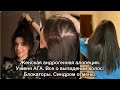 БЛОКАТОРЫ ПРИ АЛОПЕЦИИ. ВЫПАДЕНИЕ ВОЛОС. ОТ ЧЕГО ВЫПАДАЮТ ВОЛОСЫ? АГА. ВИБРОЗ. ДИФФУЗНОЕ ВЫПАДЕНИЕ 