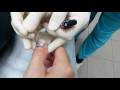 Лечение гематомы под ногтем