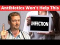 Do I Need an ANTIBIOTIC for This? [When Antibiotics Don&#39;t Work]