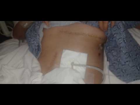 Help Me Stay Housed After My Accident photo