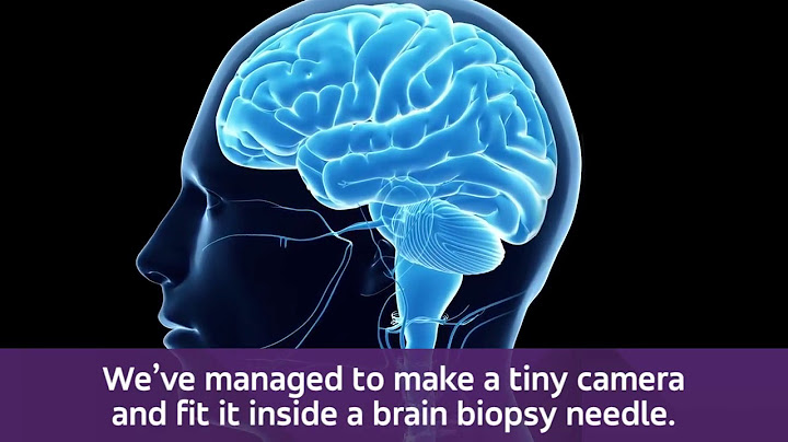 "Smart needle" could revolutionise brain surgery