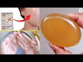 Skin brightening vitamin c soap  homemade