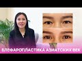 Блефаропластика азиатских век. Пластический хирург ОН КЛИНИК отвечает на популярные вопросы.