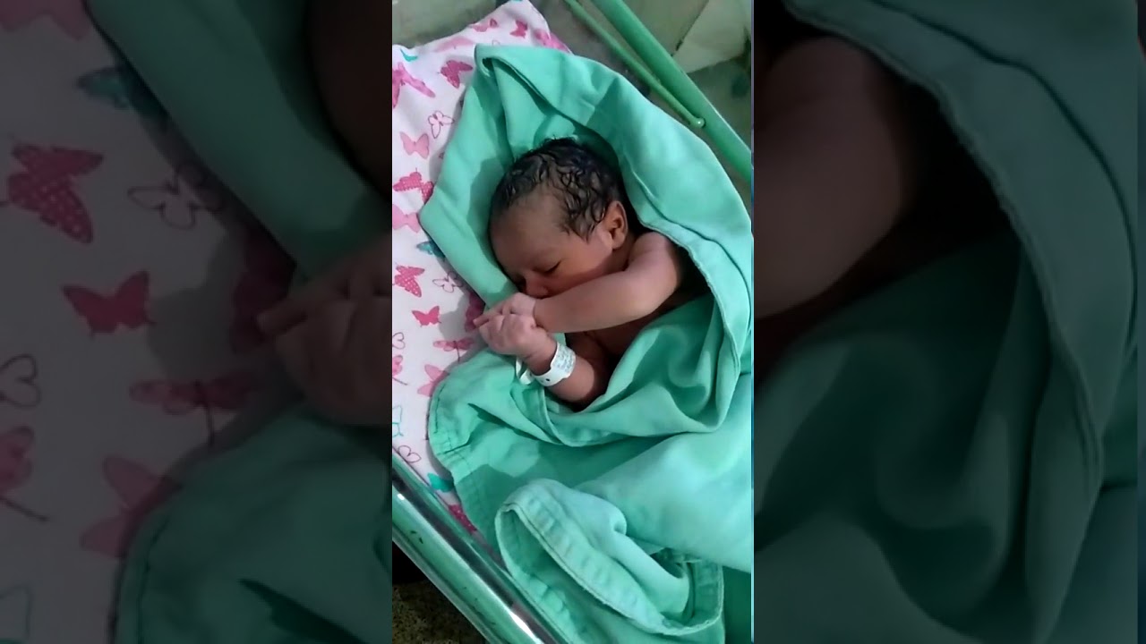 Ariela Nasceu no Parto de Tete de Hoje Terça Feira Dia 3 de Abril de 2018