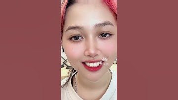 Đắp Răng Khểnh Cho Bé Đẹp Nhà e #RangKhenhSusan #tiktok #rangkhenh #Rangmeo LH: 0909 65 5257