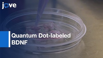 Axonal Transport of Quantum Dot-labeled BDNF in Primary Neurons | Protocol Preview