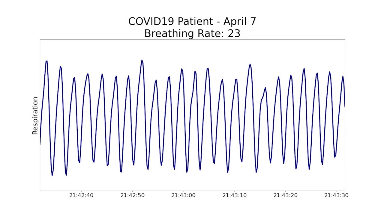 Non-contact health monitoring for COVID-19