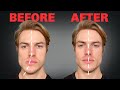 How To Fix Asymmetrical Jaw Face FOREVER 