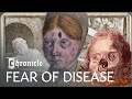 How Syphilis And Leprosy Ravaged The Medieval World | Medieval Dead | Chronicle