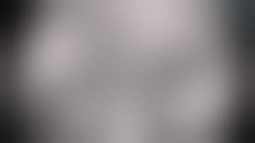 Associating liver partition and portal vein ligation for staged hepatectomy (ALPPS)