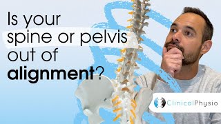 Is Your Spine or Pelvis out of Alignment? | Expert Physio Review
