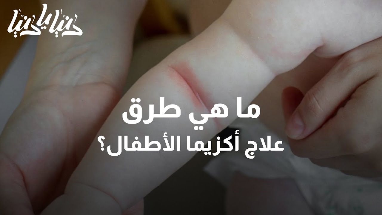 أكزيما الأطفال: ما هي طرق علاجها وما هي سبب الإصابة بها - دنيا يا دنيا #أكزيما_الأطفال