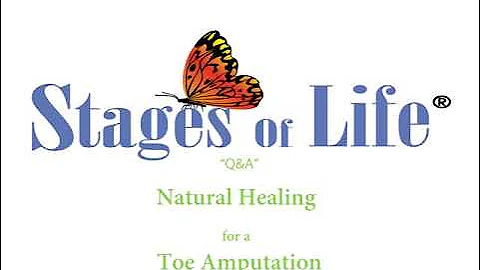 Natural Healing for a Toe Amputation
